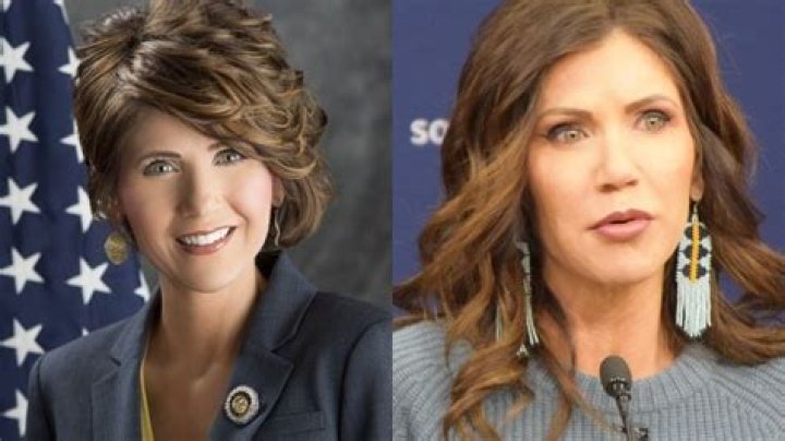 Kristi Noem's Plastic Surgery Transformation: Before And After